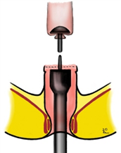 PIC4FBA.png