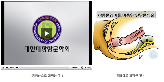 PIC50D5.png