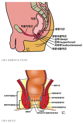 PICC75A.png